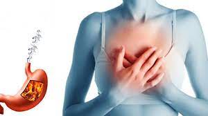 Декілька простих порад для тих, кого часто турбує печія